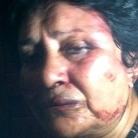 Ana Luisa Pardo Nøgen