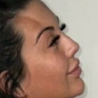 Chlofans Nøgen