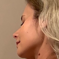 Dorota4474 Nøgen