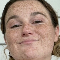 freckledbabyy Nøgen