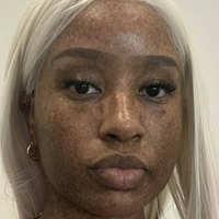 freckledn Nøgen