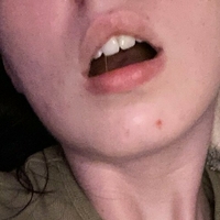 garbage_bunni Nøgen