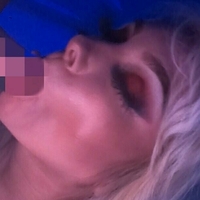 hailratchetredd Nøgen