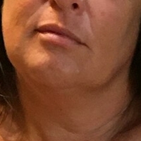 Lady Lara Nøgen