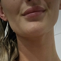 Marie Müller Nøgen