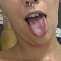 NathFox Nøgen
