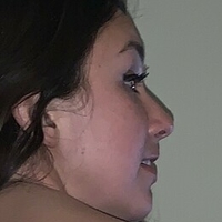 Ronisofine Nøgen