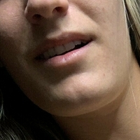 shinytara Nøgen