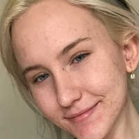 Trippi Miki Nøgen