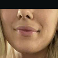 Wettmelons Nøgen