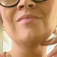 yournurse.amber Nøgen